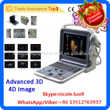 Christmas Promotion!! MSLCU28i 4d color doppler portable ultrasound machine price